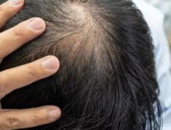 TIPS MENGATASI RAMBUT RONTOK